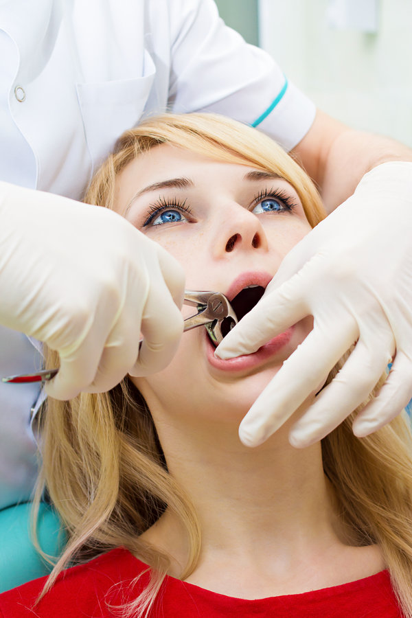Closeup young woman at dentist clinic office. Male doctor and assistant performing extraction procedure with forceps removing patient tooth. Healthcare dentistry medicine concept