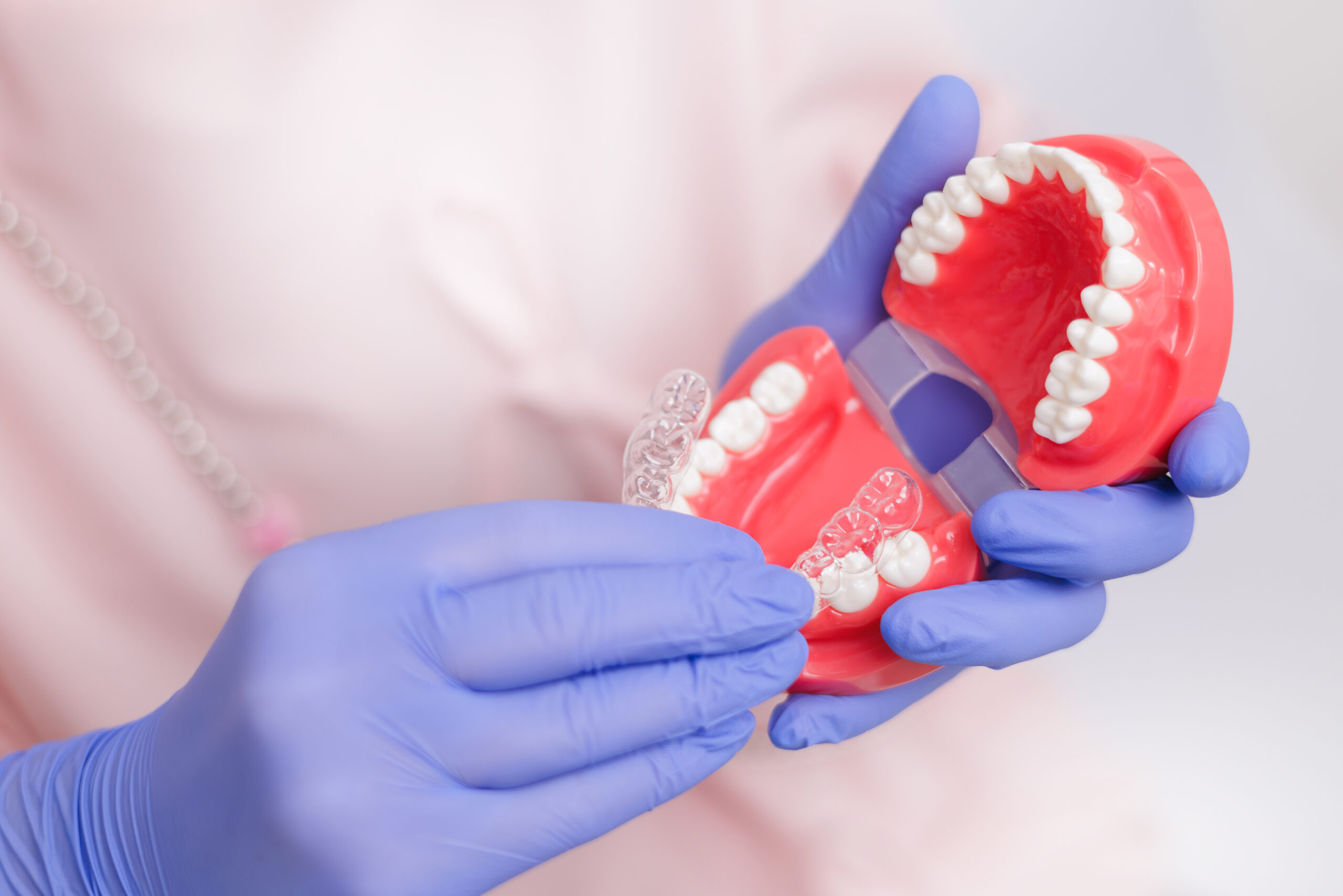 Gloved hands demonstrating dental model with aligners, orthodontic appliance to make teeth straight.