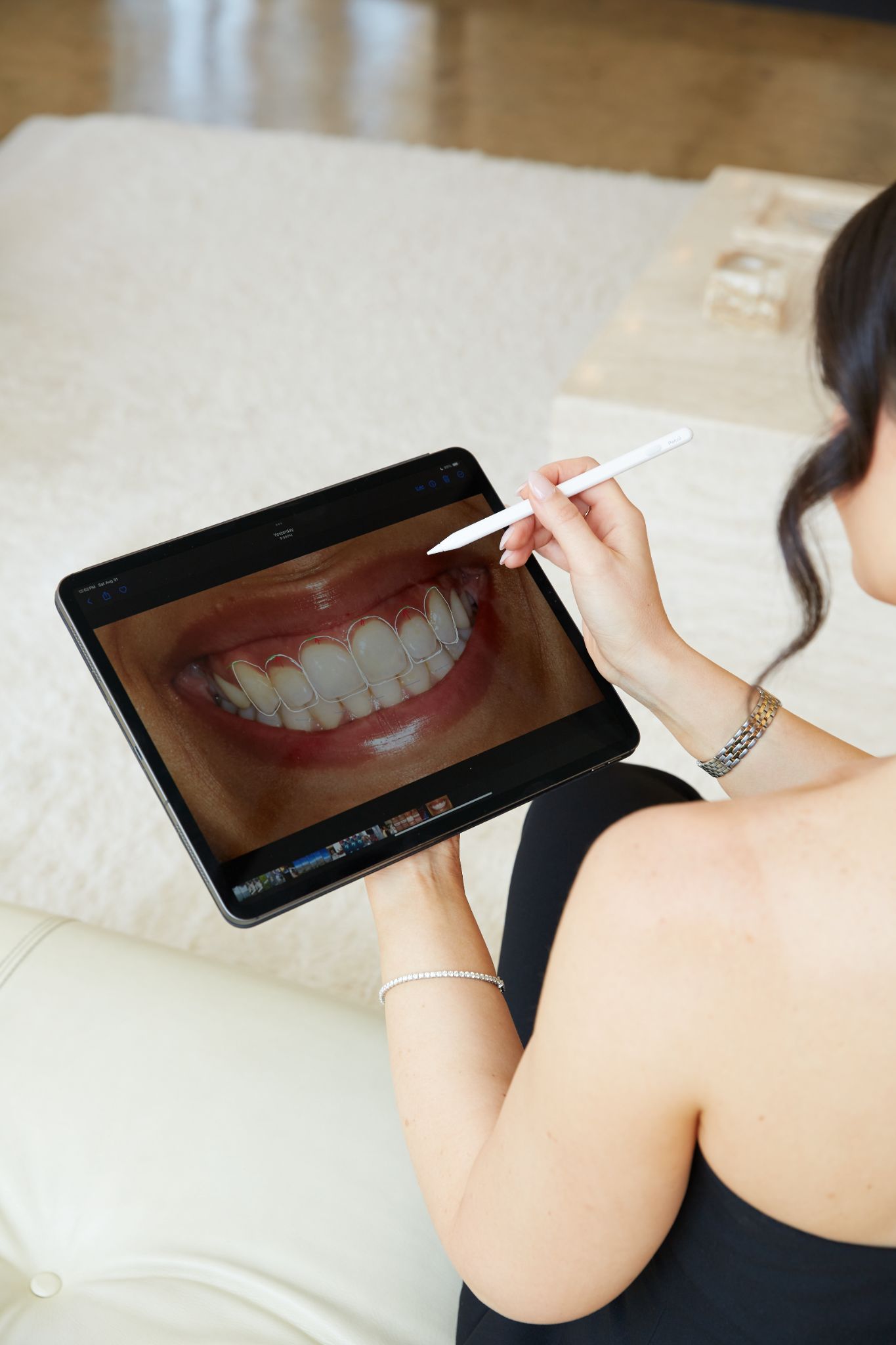 Veneers in Laguna Beach