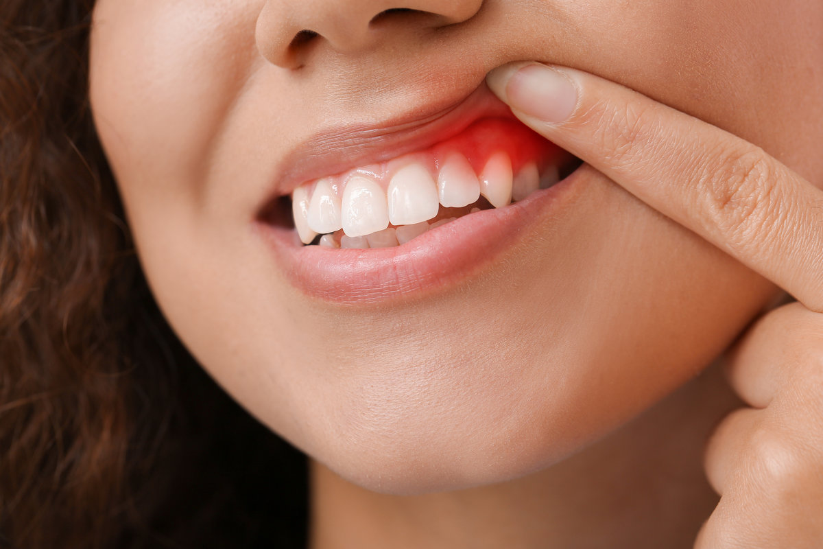 AdobeStock 411128722 - Lalume Dental Studio